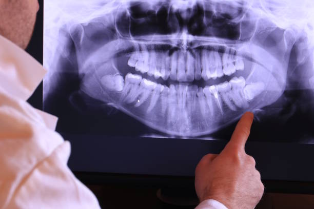 Best After-Hours Emergency Dentist in Springhill, LA
