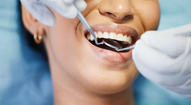 Best Emergency Root Canal Treatment in Springhill, LA